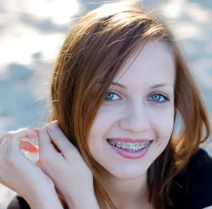 When Orthodontic Treatment Is Needed for Adults and Teens