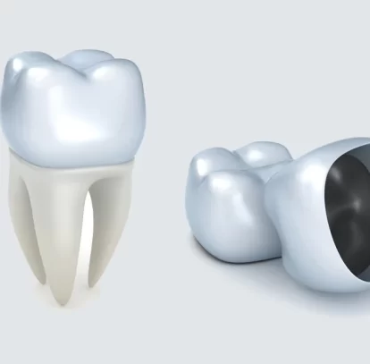 How Do Dental Crowns Restore Strength After a Broken Tooth?